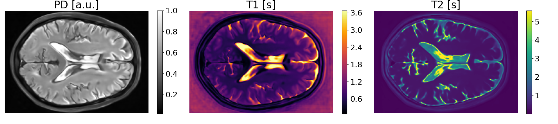 Physics-informed latent diffusion for multimodal brain MRI synthesis
